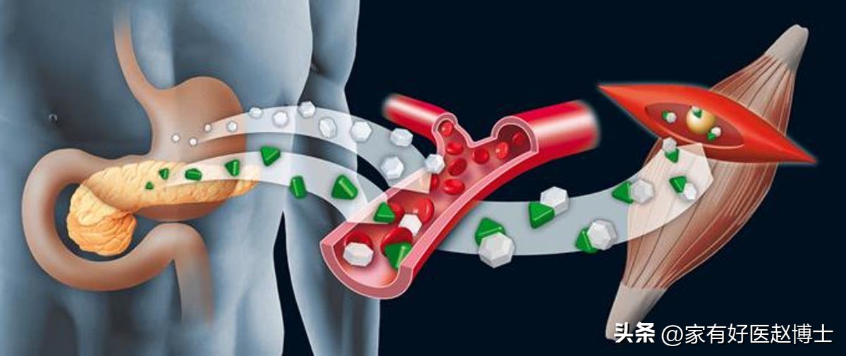 糖尿病患者身体出现这4个表现,糖尿病日常六个表现警惕肾脏损伤