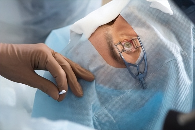 青少年近视激光手术哪家好,近视300多度想做激光治疗怎么办