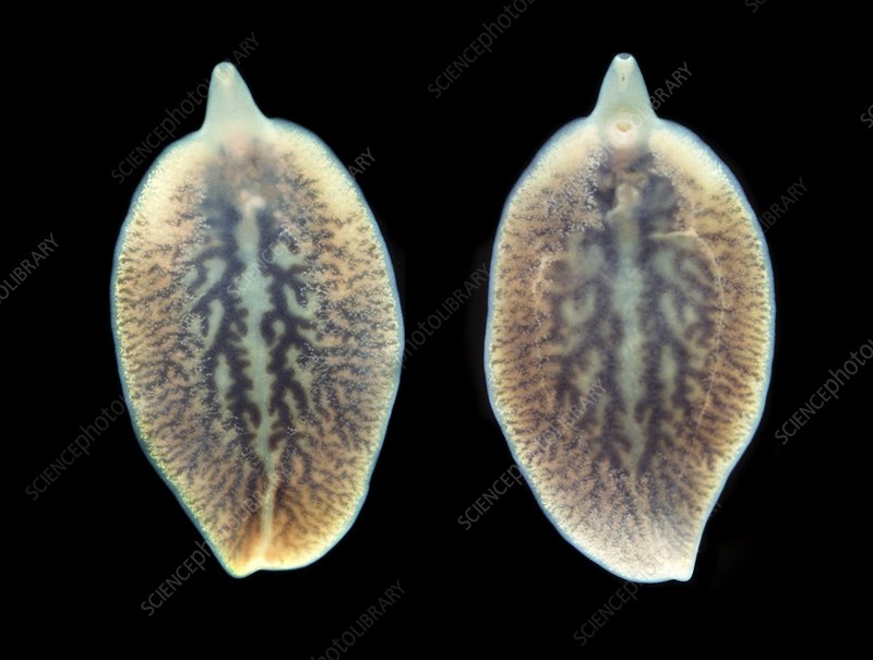 鐢峰瓙鍙嶅鍙戠儹绔熸槸鎮ｄ簡鑲濆惛铏梾,鑲濋儴鎰熸煋瀵勭敓铏槸鎬庝箞鍥炰簨