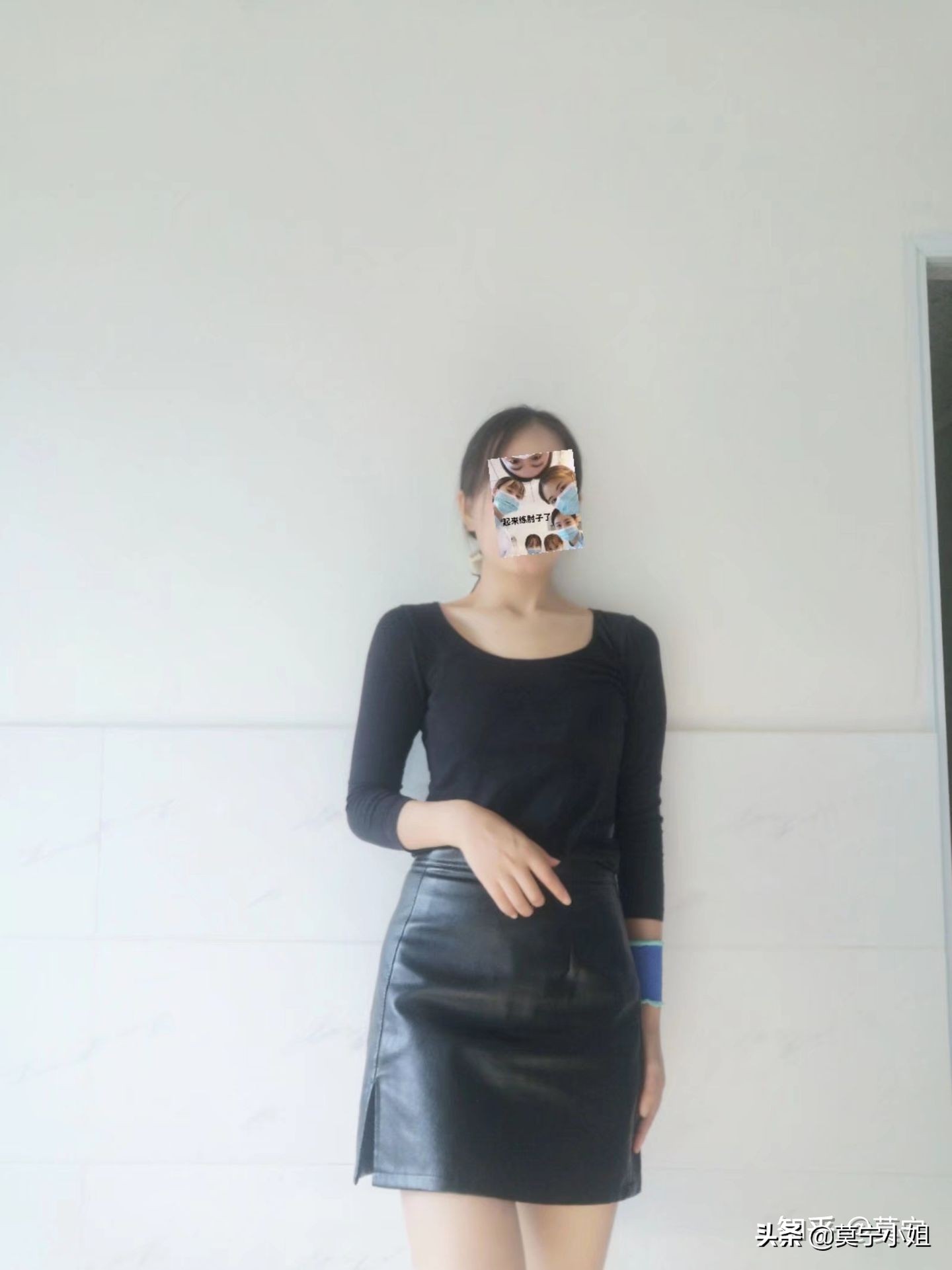 肘关节严重活动度受限康复,肘关节屈曲受限康复训练方法