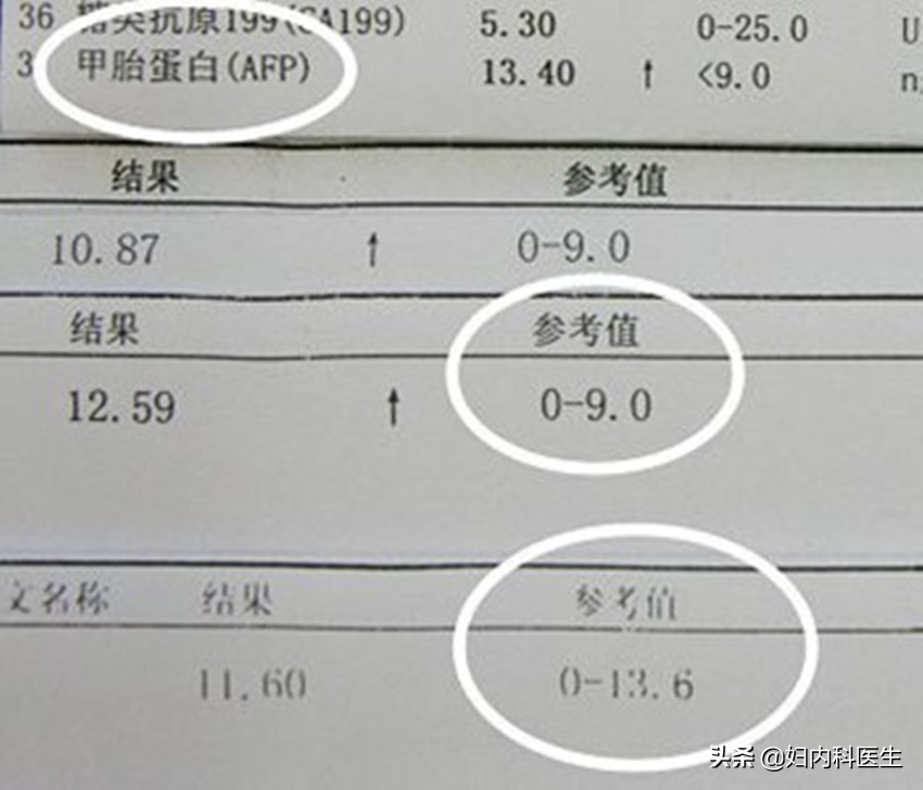 检查单上的指标怎么才能看懂？医生一文解释清楚