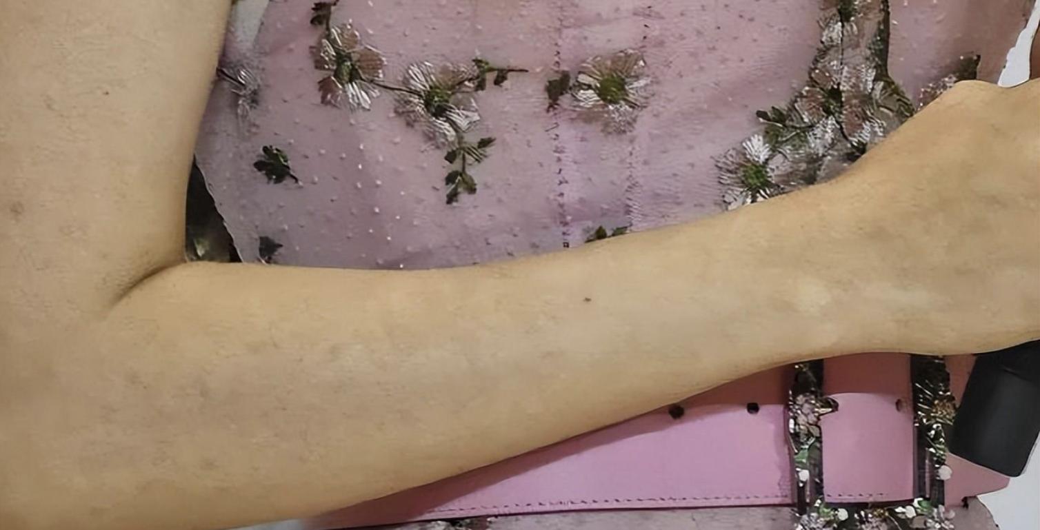 娱乐圈还有哪些假臀假肌肉,假臀假肌肉假肩膀的明星们