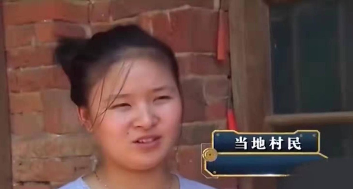 男子手长满树疙瘩是什么病,男子手长满树疙瘩手术了吗