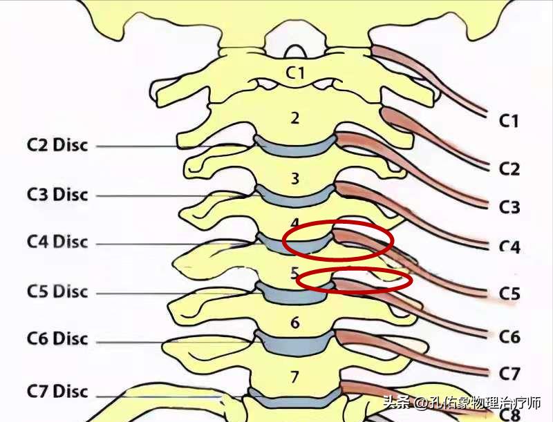 颈椎引起手麻胳膊腿无力,颈椎压迫神经胳膊无力手麻怎么治