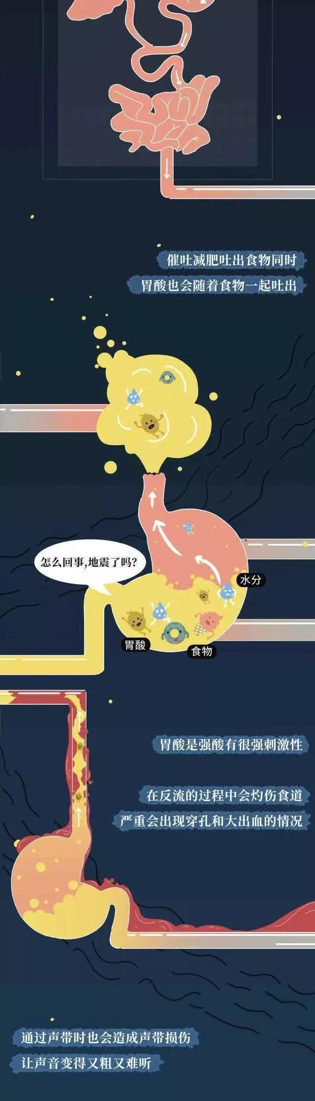 女孩是怎么把“仙女管”插入体内的？提醒：别盲目效仿