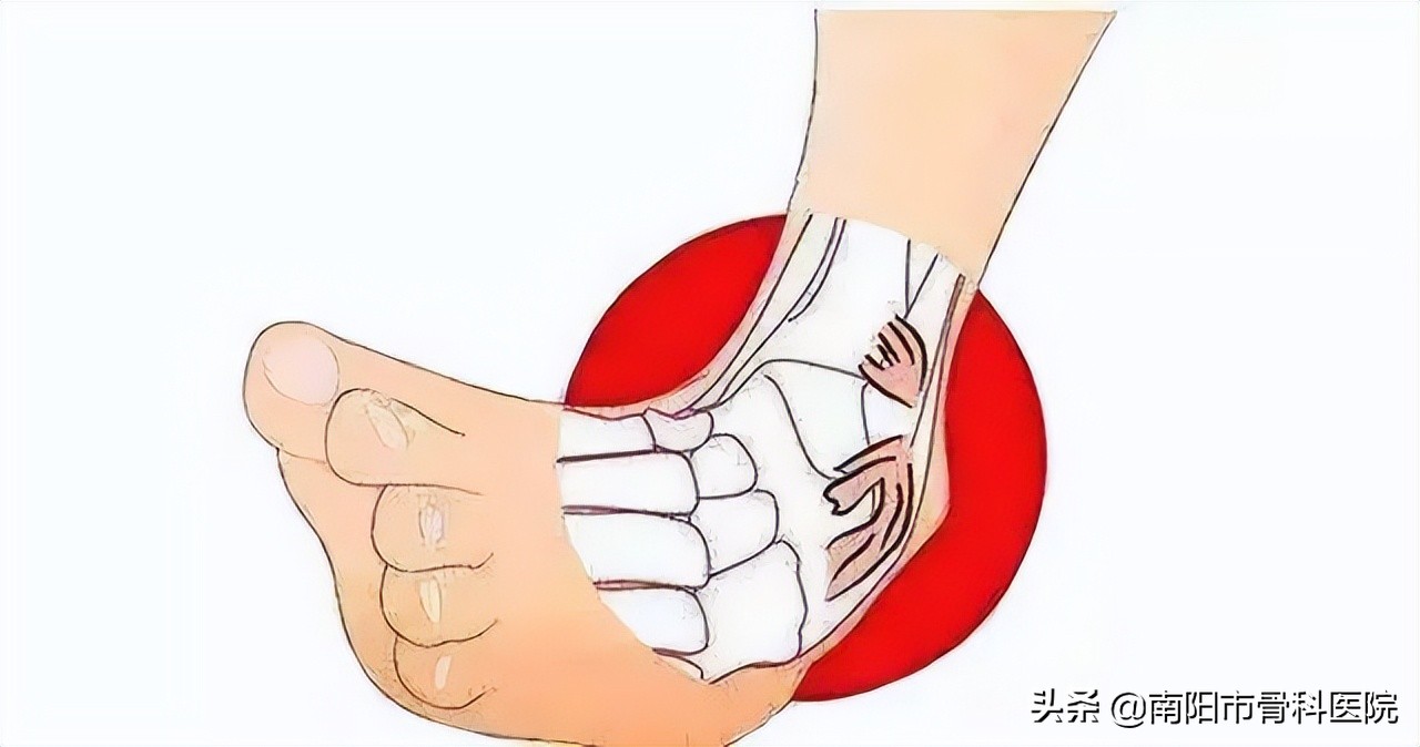 脚踝扭伤怎么办幼儿园,脚踝扭伤怎么办