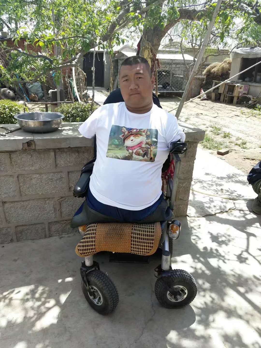 无手无脚筷子哥有孩子吗,天生无四肢筷子哥