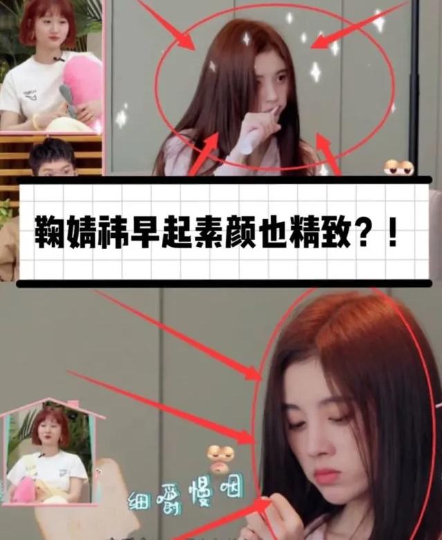 整容了就是不承认,这些女星被质疑整容脸