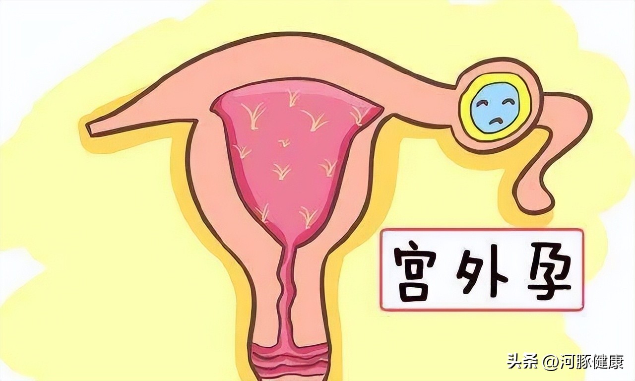 这位医生，总问我的*生活性**是什么意思？