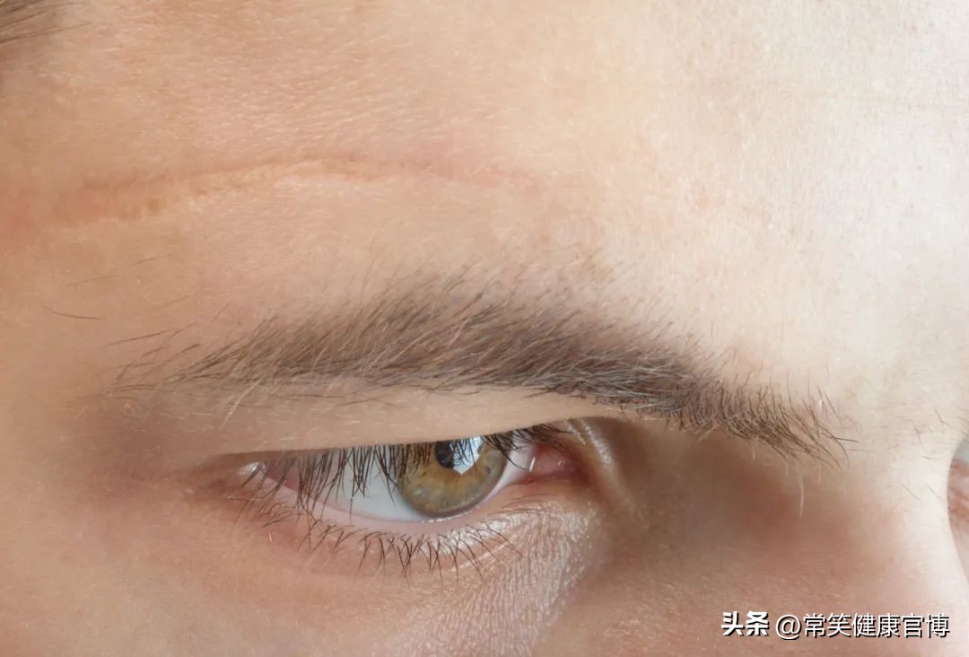 中国治疗疤痕去哪家整形医院,长了疤痕疙瘩怎么治疗多少钱