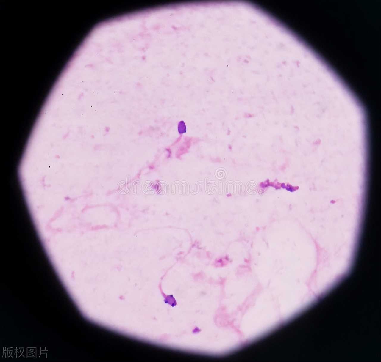 重度弱精可以吃凯贝尔锌硒片吗,重度弱精可以做一代试管吗