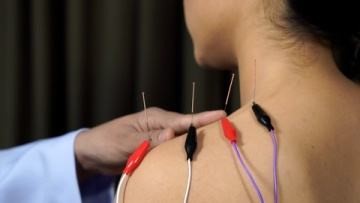 腰肌劳损电疗放血,腰肌劳损用低频脉冲理疗仪管用吗