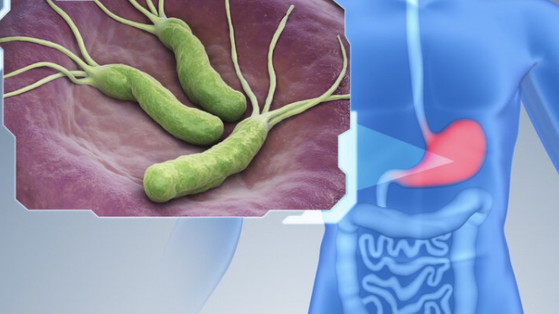 一瓶100毫升甲硝唑多少钱,几块钱的甲硝唑能有三种作用