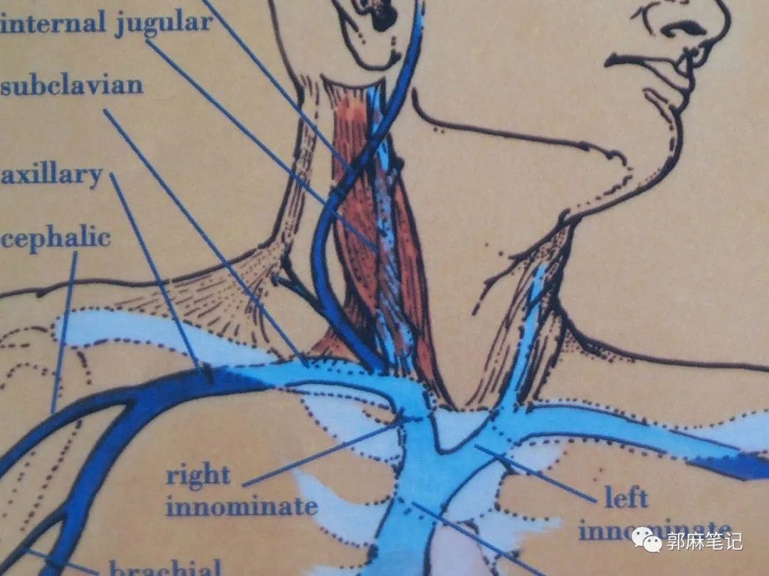 中心静脉穿刺置管术ppt免费,中心静脉置管的护理ppt