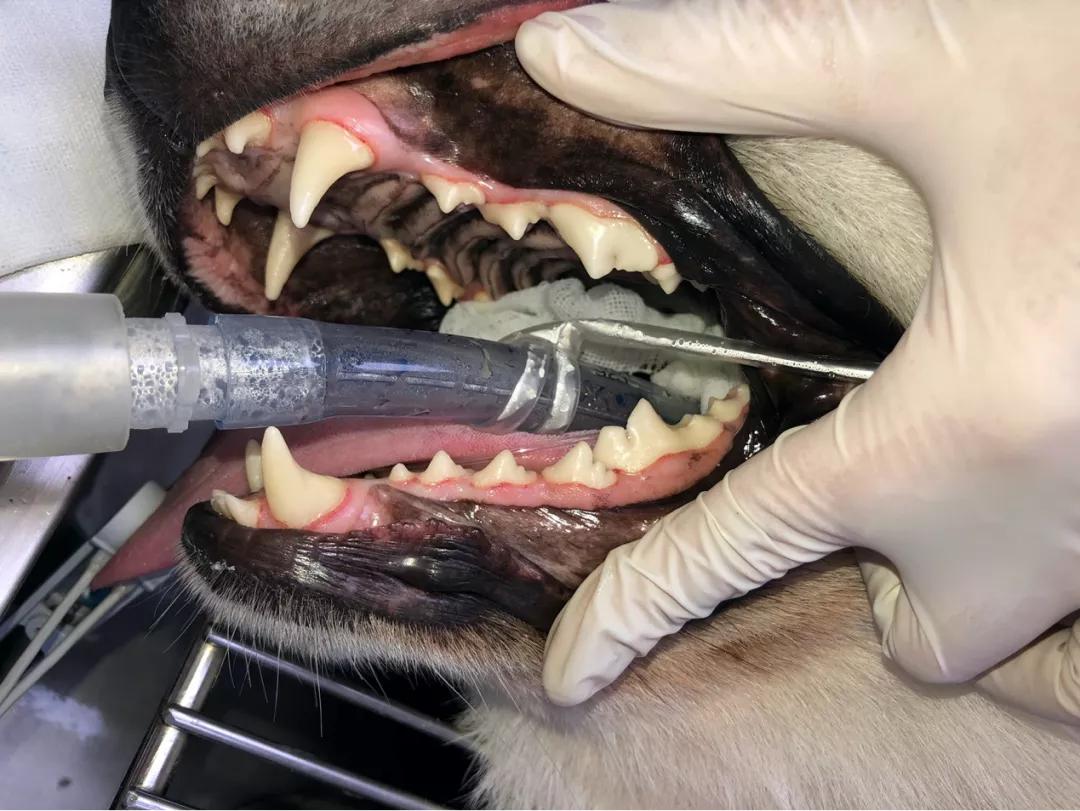 牙釉质发育不全能矫正吗,牙釉质发育不全怎么补救