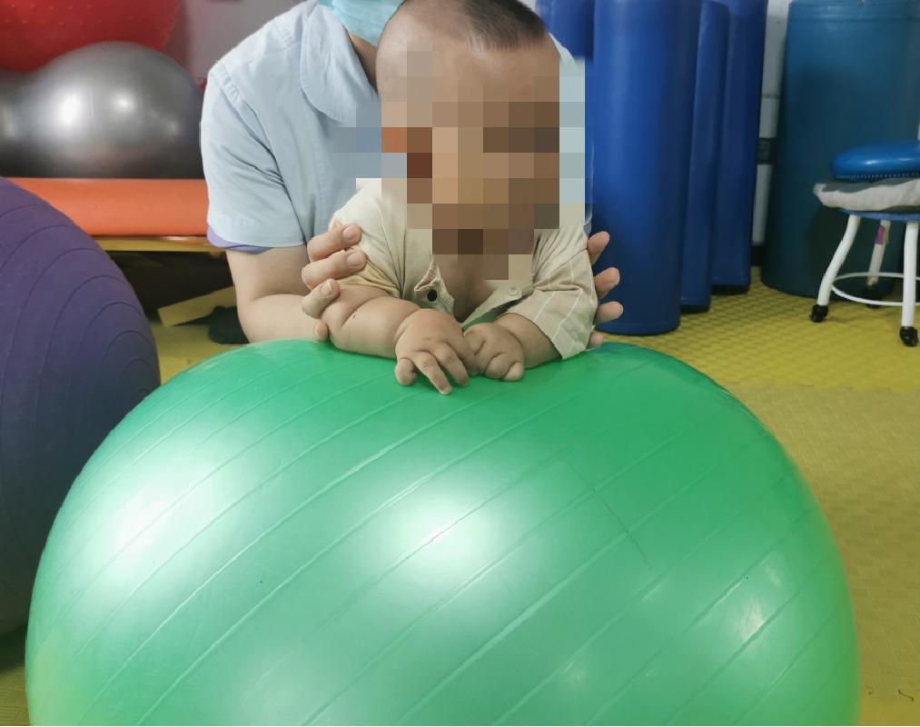 脑瘫康复与脑梗康复,小儿脑瘫在家可以做康复训练吗