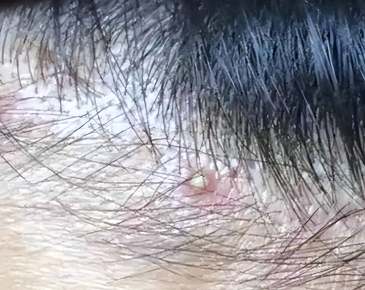 头皮里长的脓包疙瘩是什么原因,头皮上总是长疙瘩和脓包如何根治