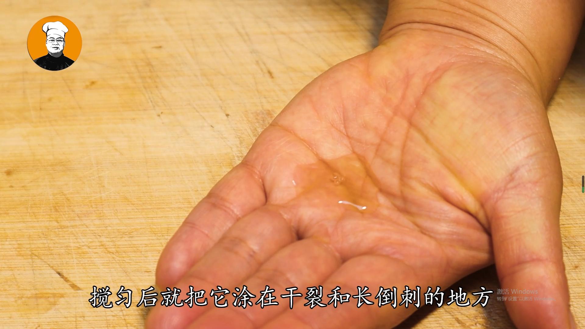 冬天手裂口脱皮擦什么最好,手脚粗糙干裂倒刺