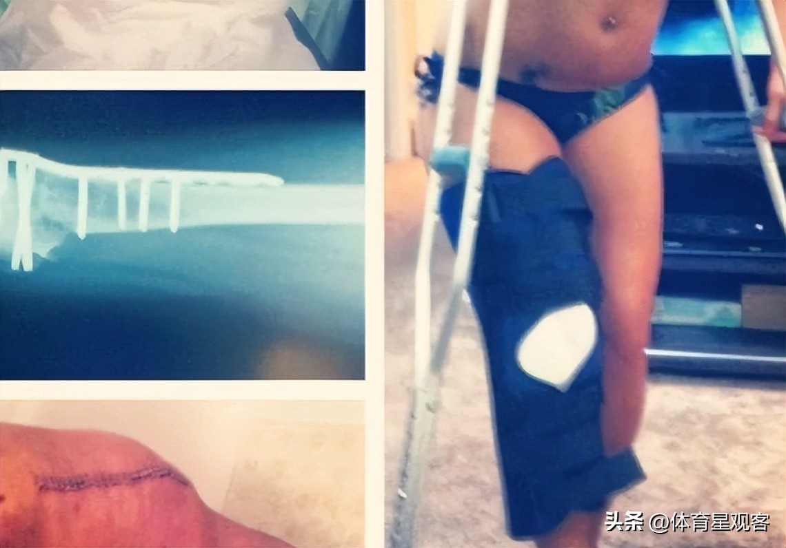 “美国最强壮女人”圣诞前夕自杀，躲得了车祸，却躲不了男友PUA