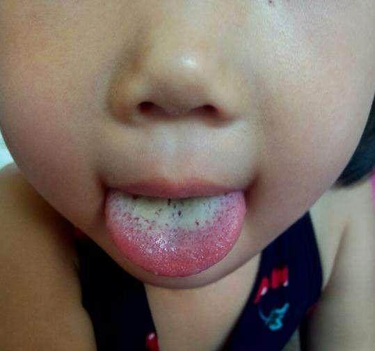 孩子不长肉不长高怎么治,孩子光长个子不长肉怎么调理