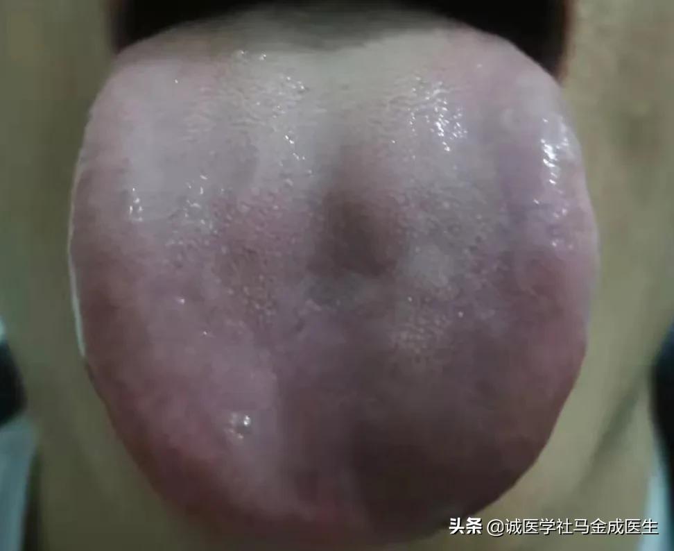 一吃凉的就胃痛食疗方法,吃了凉性食物胃痛怎么缓解