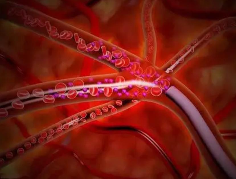 基于“肾虚、湿浊”理论，来探讨多系统萎缩的病机特点及治法