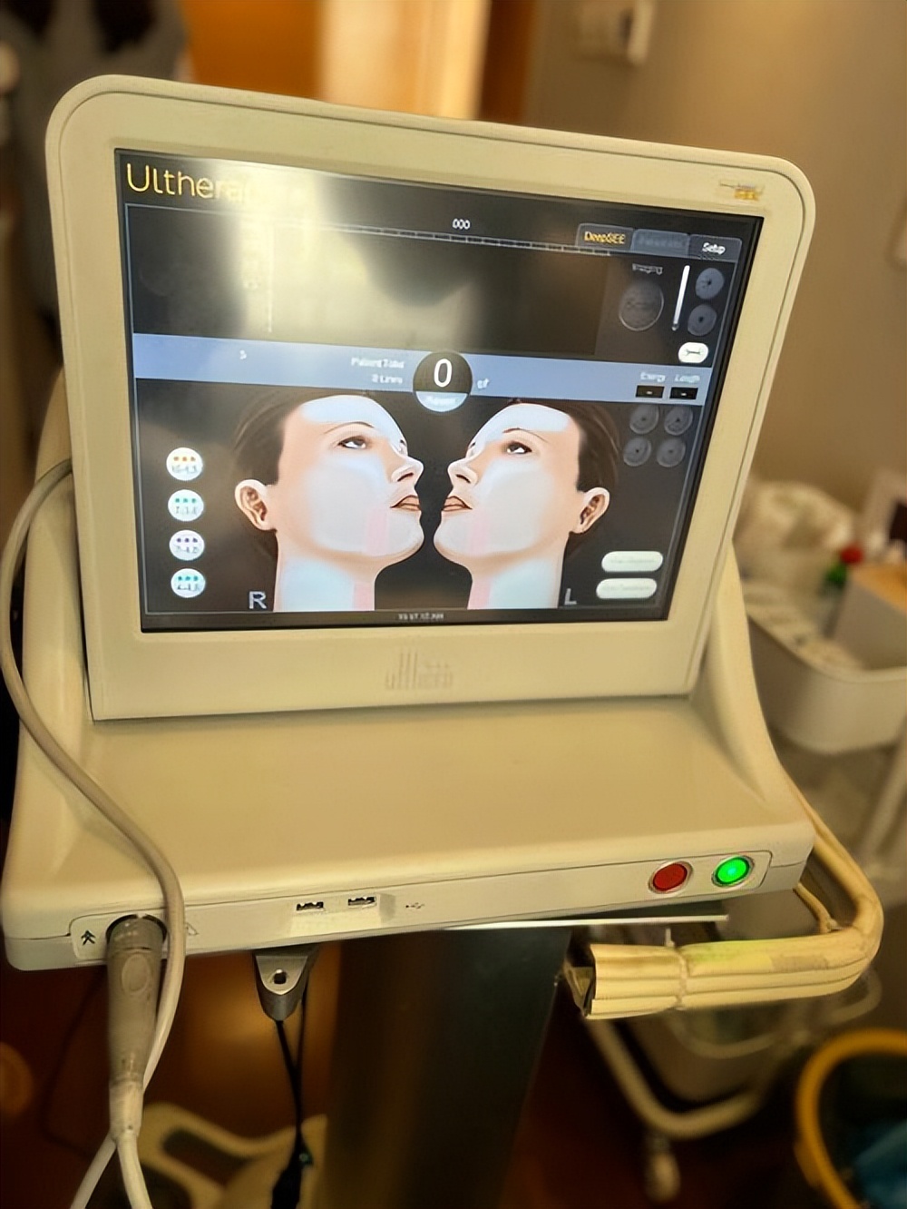 【科普】子宫内膜癌有两种类型，你了解吗？腹腔镜手术效果如何？