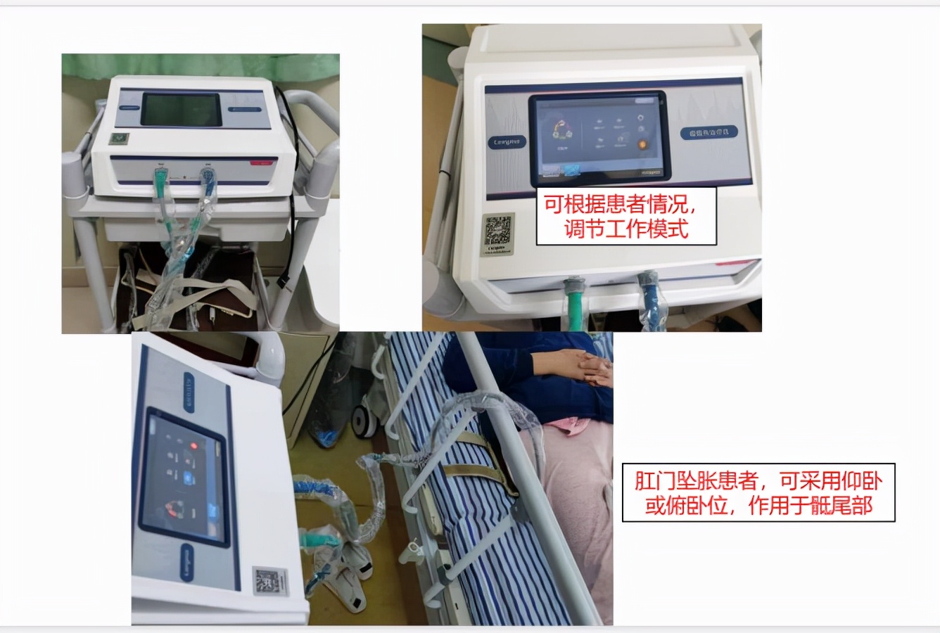 中医肛肠和中西医结合肛肠,菊花根治肛肠病