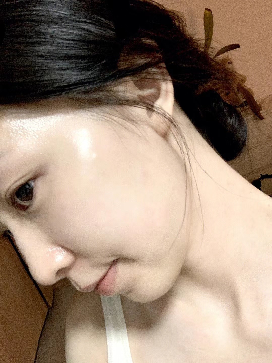 下巴总长痘痘抹什么药,下巴总长痘痘和闭口怎么办