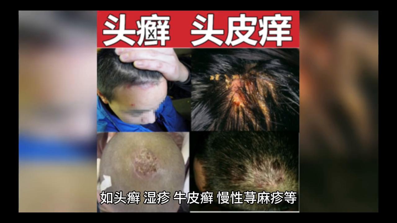 成为民航空姐条件,民航空姐择偶条件