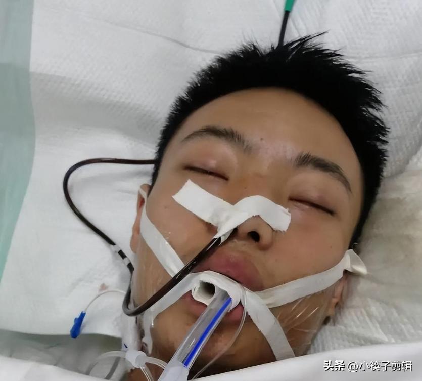 四川被捅小伙花200万治疗,四川被捅小伙确认去世后续