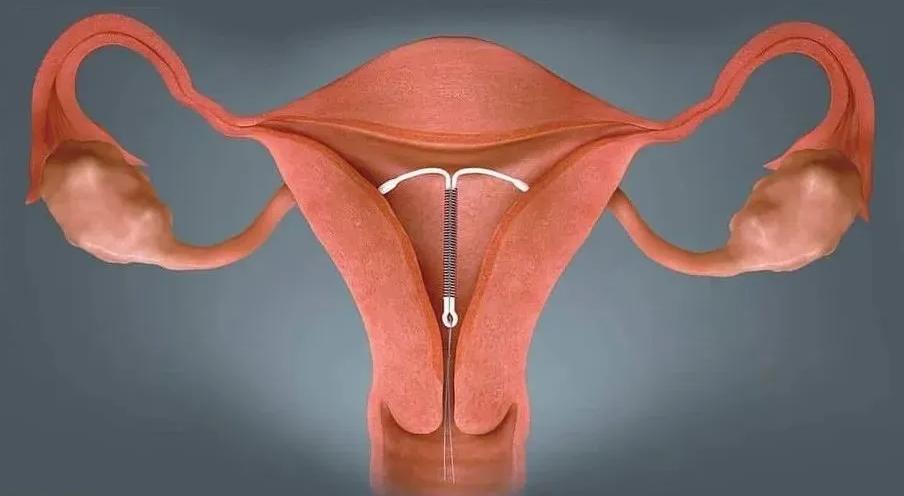 安全套安全性高吗,安全套对身体有没有伤害