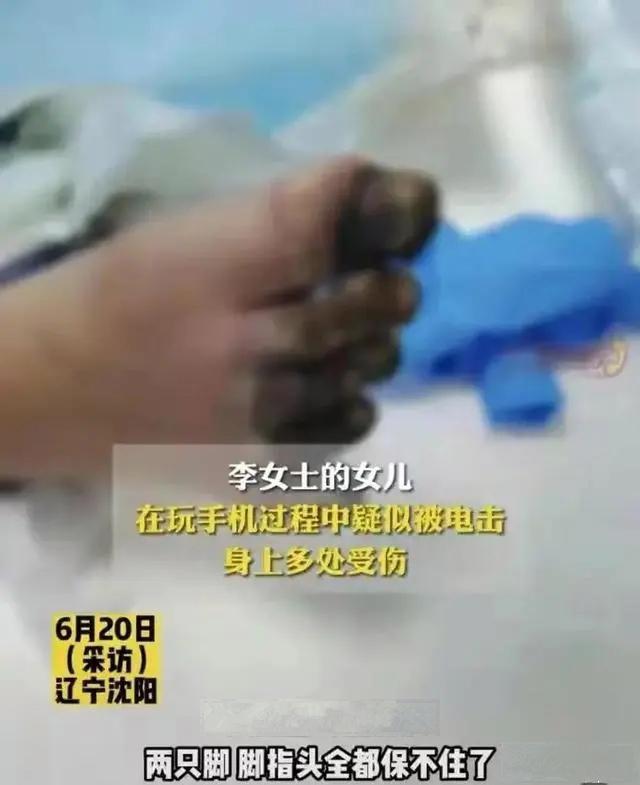 女孩充电玩苹果手机遭电击,女孩充电时玩手机被电击面临截肢