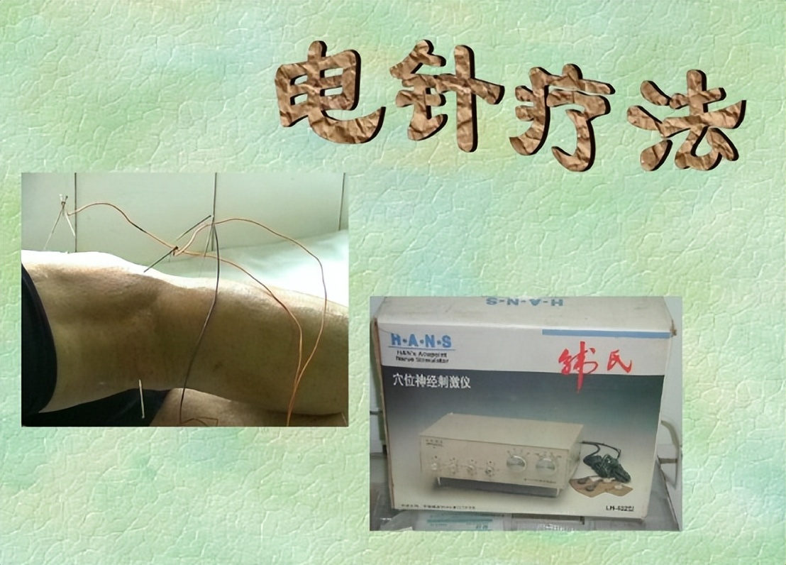 中风并发症会增加病死率，中医特色疗法针灸治疗效果如何？