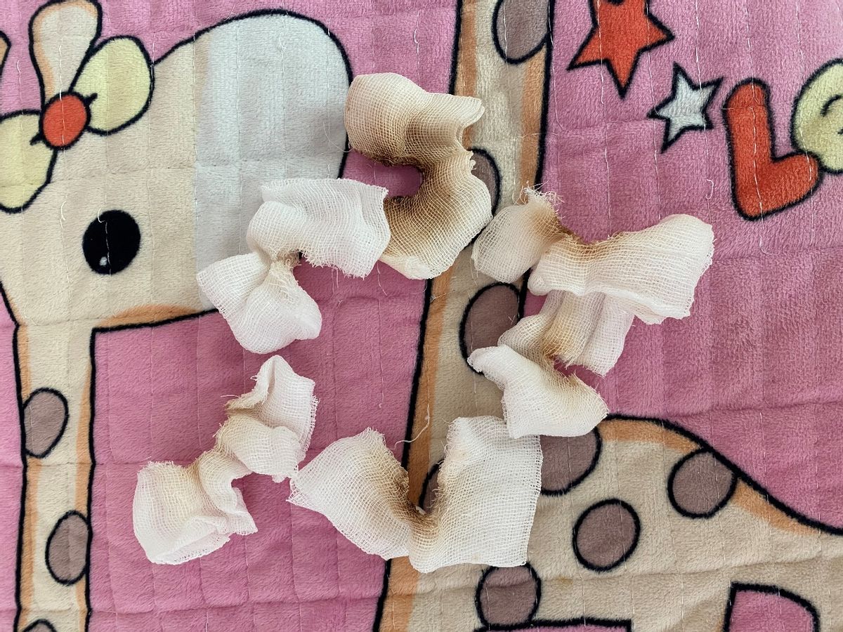 一针70万的救命药后续,70万一针的救命药能救什么