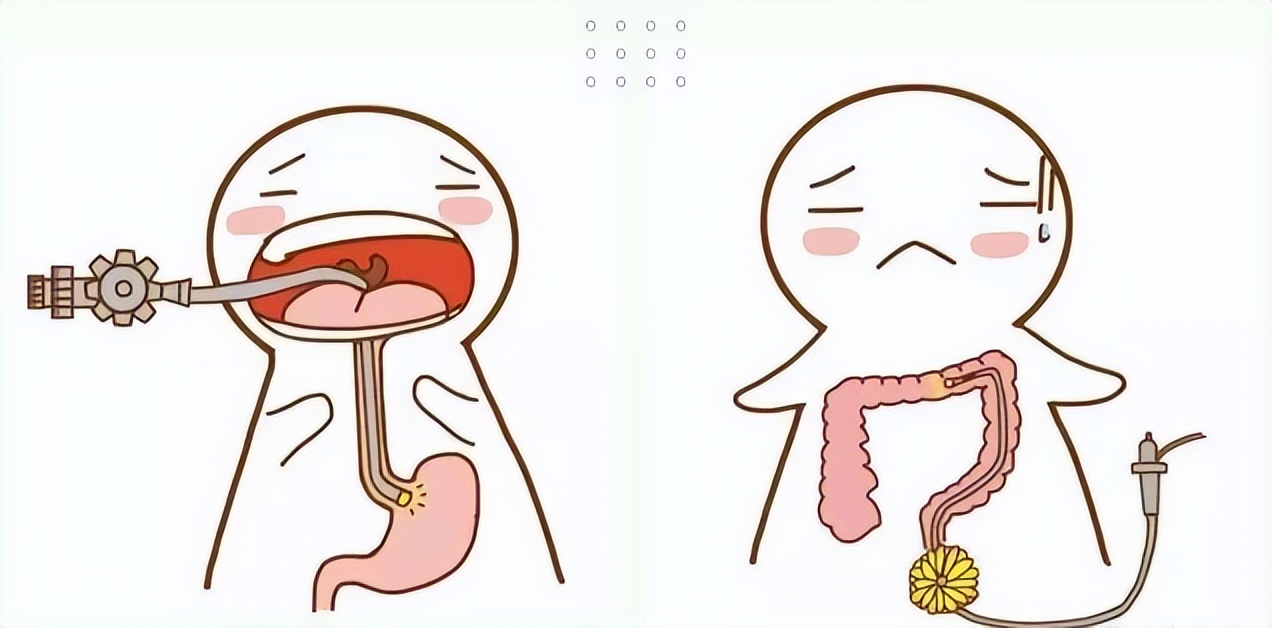 胃肠息肉切了又长，防治磨人的小妖精，6大要素，快拿小本记下来