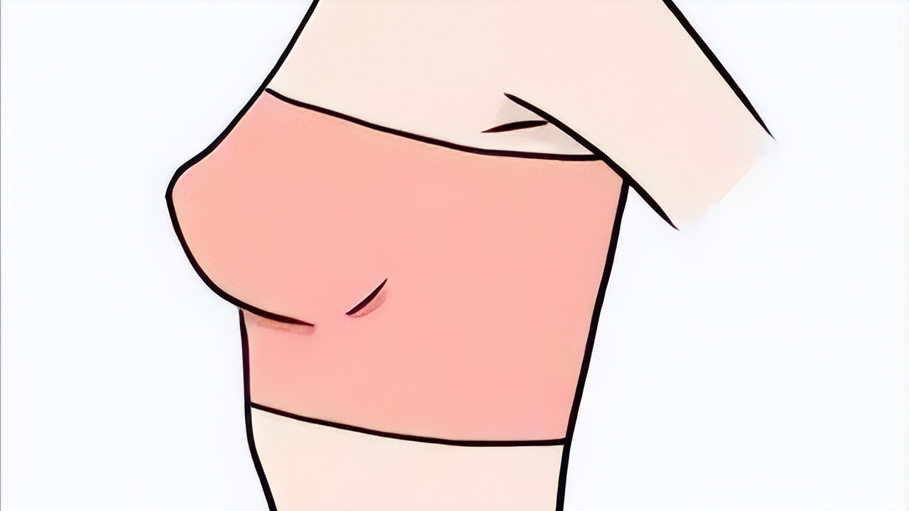 长期穿背心胸罩会导致乳房下垂吗,不经常穿内衣会导致乳房下垂吗