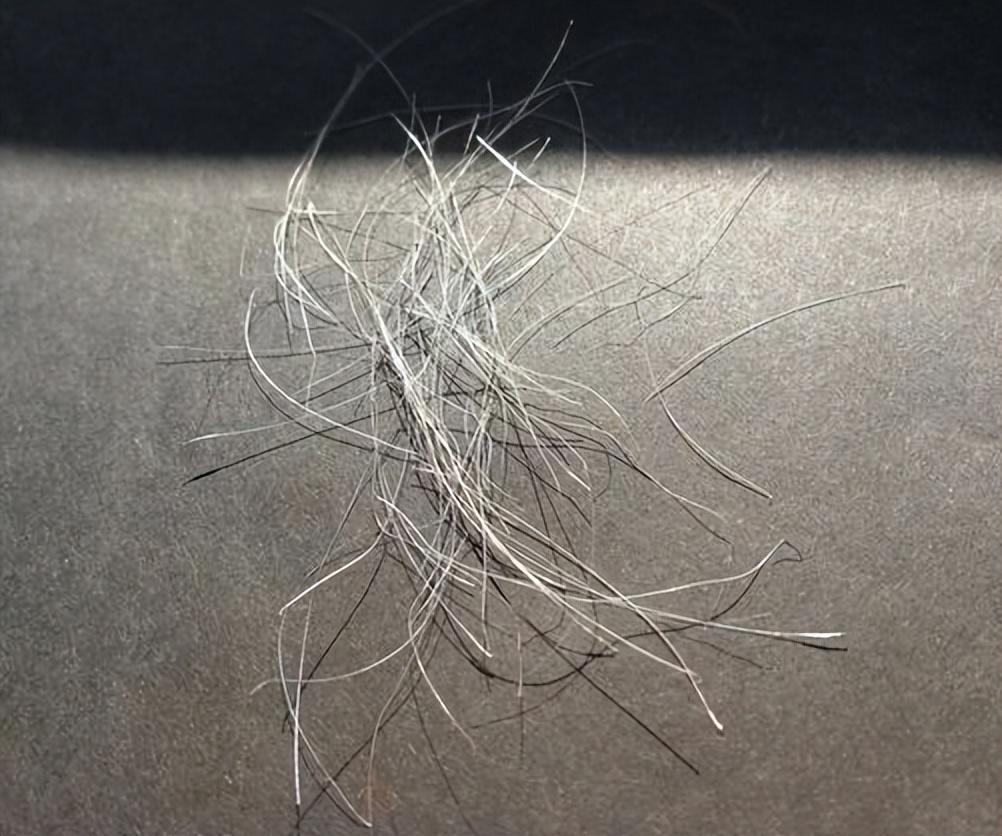 阴毛变白是身体生病了吗？