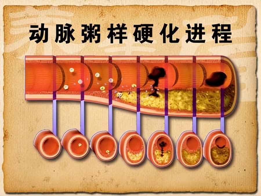 头晕怎么判断是什么原因引起的,头晕是什么原因引起的早期症状