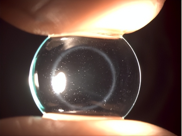 角膜接触镜验配案例图解,戴角膜塑形镜反复出现点染的原因