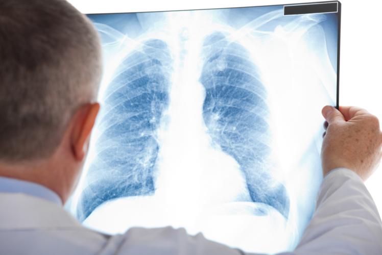 吃虾对肺结节有好处吗,虾对肺结节有没有影响