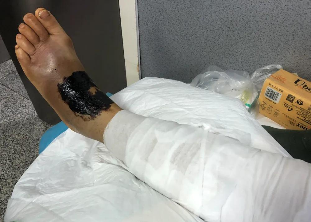 卧室内惊现毒蛇,长沙一家出现毒蛇