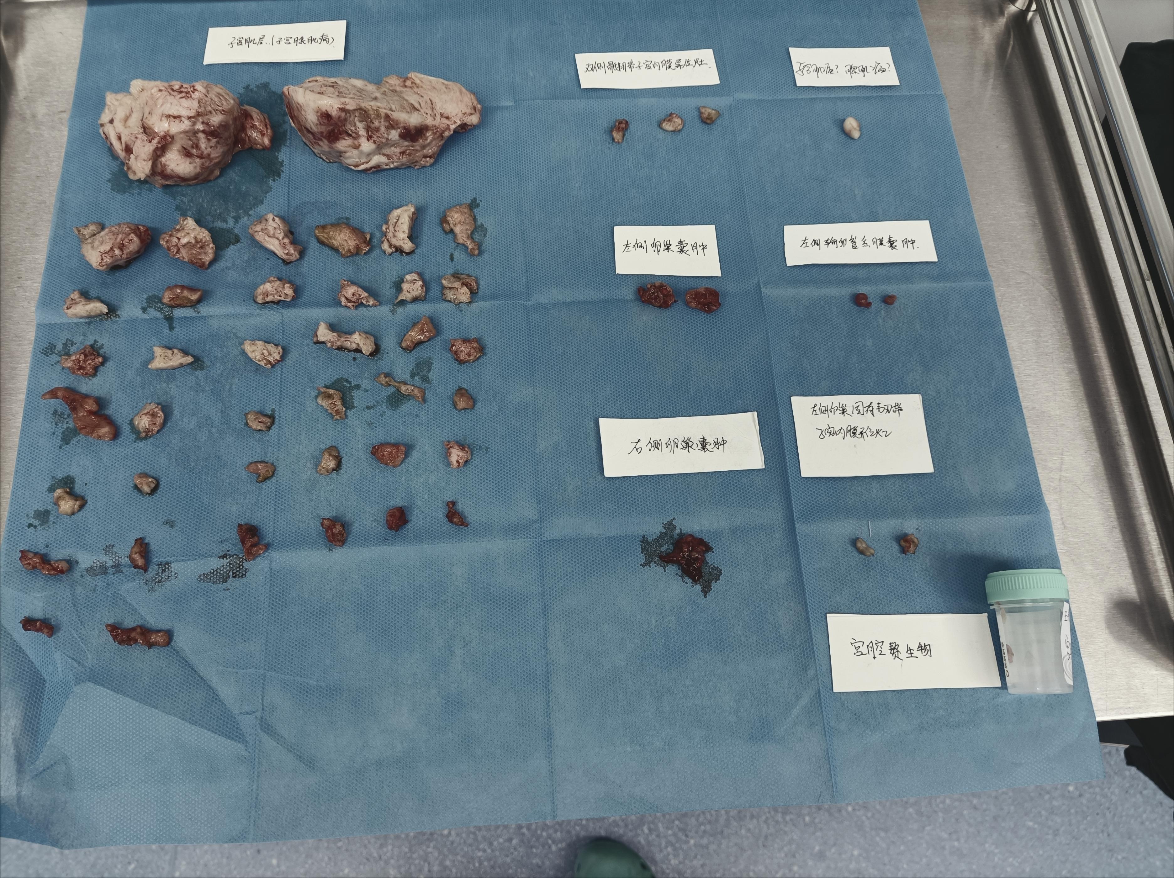 痛经从18岁到32岁了还痛经,门诊日记30篇