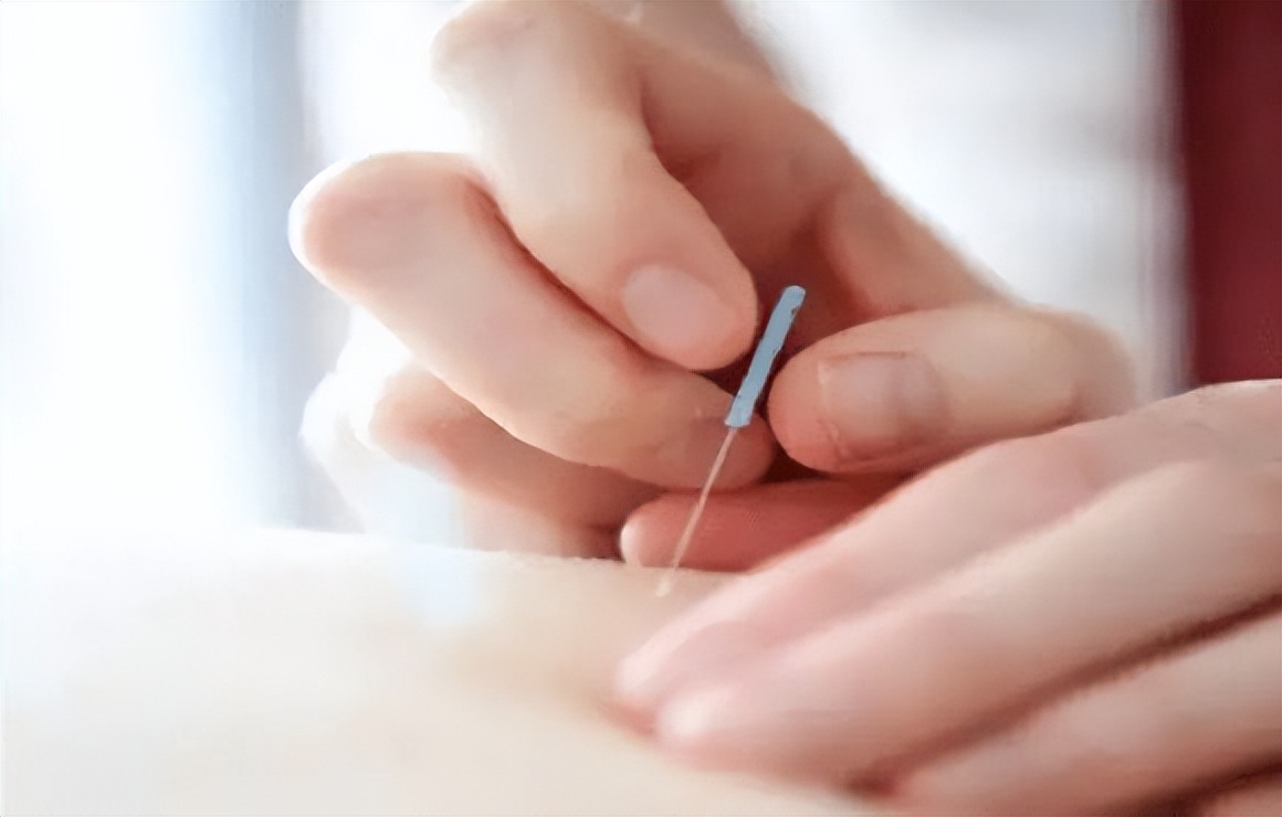 治腰椎间盘突出埋线得几天见效,腰椎间盘突出电针灸治疗的原理