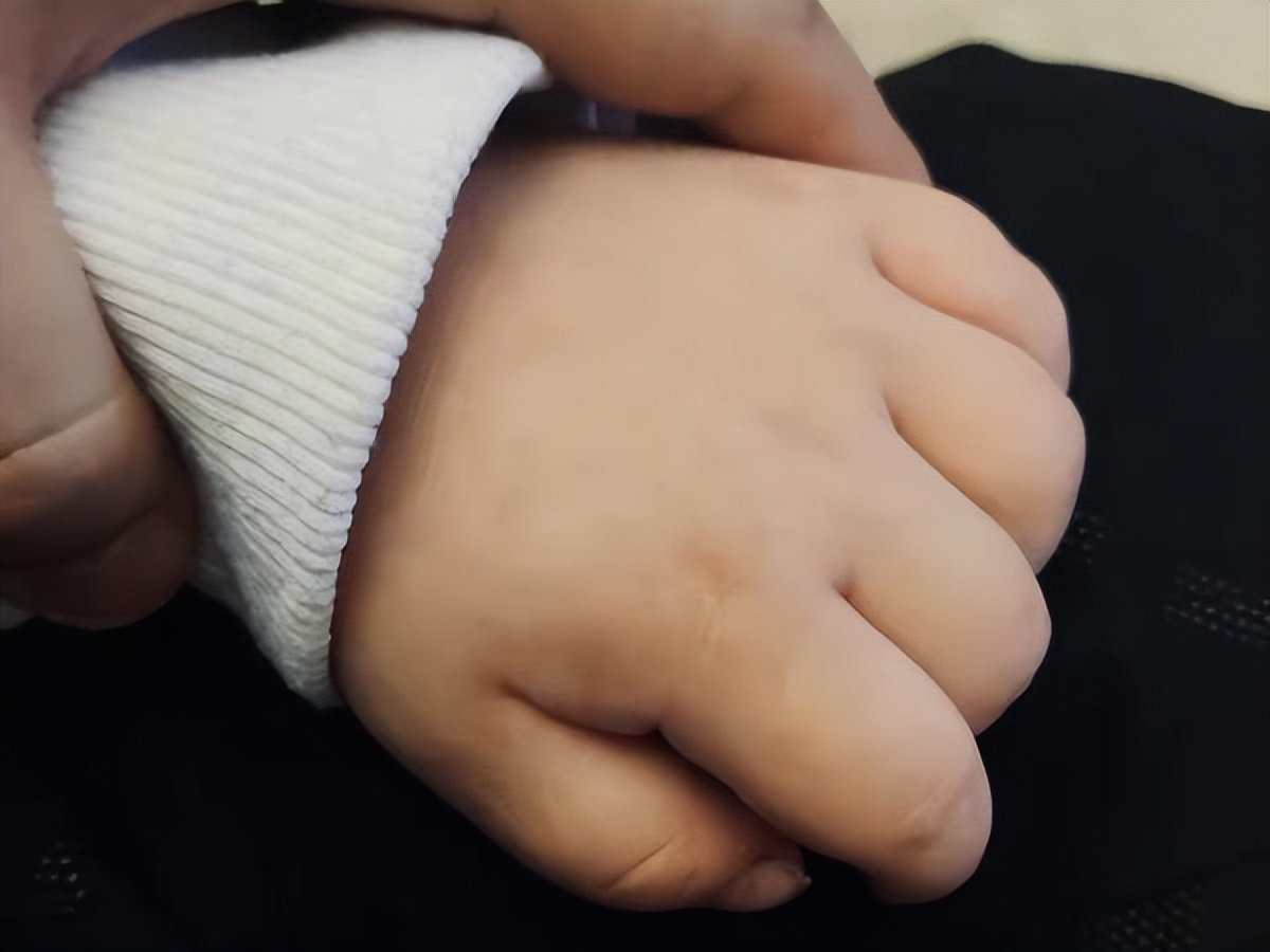 顶端100℃丨代购失联、患儿买不到药…氯巴占急需“身份证”