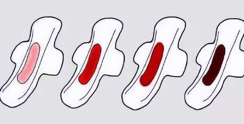 例假一股一股涌出来血块怎么回事,来例假流出一大坨血块