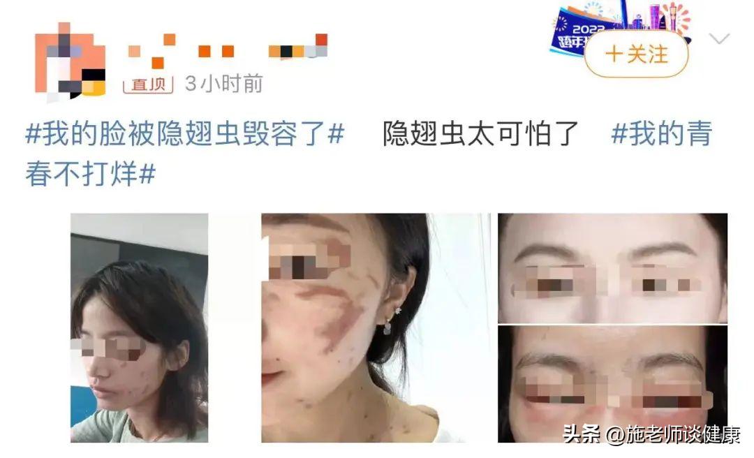 常见的虫子有哪些不能用手拍,上热搜遇到这种虫子千万别用手拍