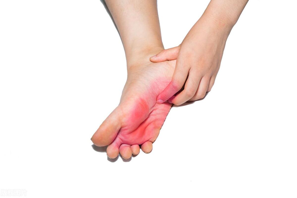 脸上长水泡型脚气严重怎么办,不注意个人卫生会得脚气