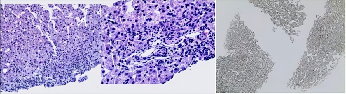 肝囊肿和肝占位影像学鉴别,杨永峰医生个人简历