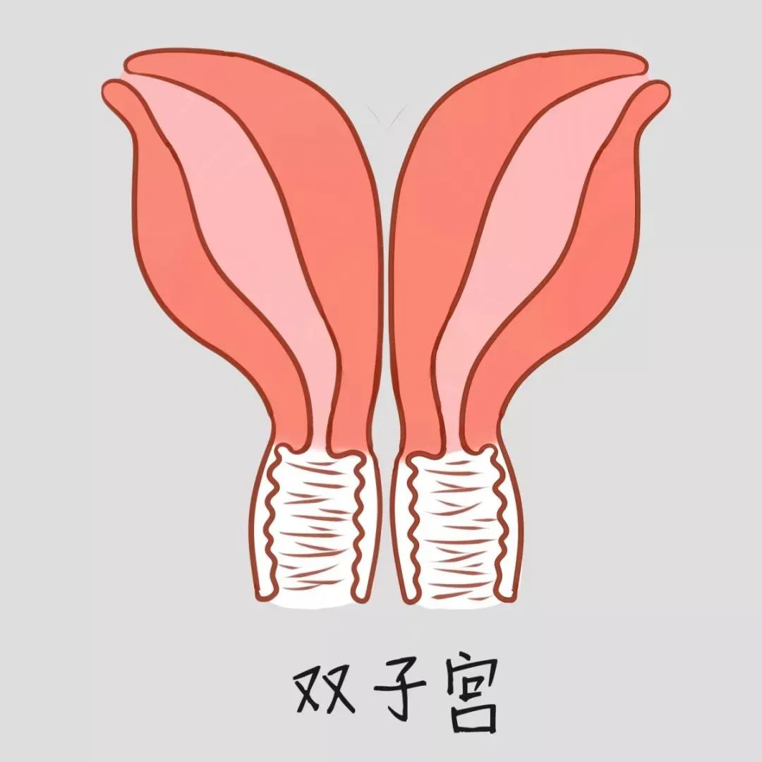 医生，B超提示我有子宫畸形，怎么办？